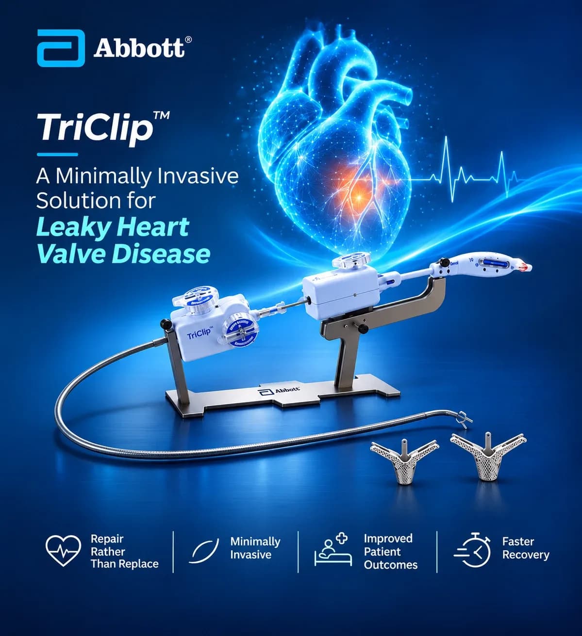 إعلان من Abbott لجهاز TriClip: علاج تسرّب صمامات القلب بأقل تدخل جراحي — إصلاح الصمام بدلاً من استبداله، ونتائج أفضل للمرضى، وتعافٍ أسرع.